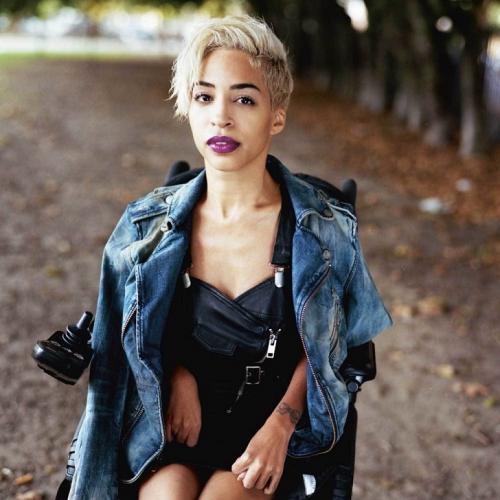 Модели, которые вдохновляют не только красотой, но и невероятной силой духа