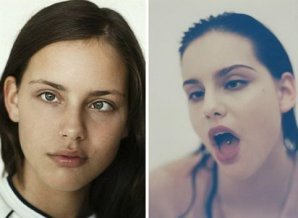 Модели, которые вдохновляют не только красотой, но и невероятной силой духа