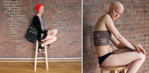 Модели, которые вдохновляют не только красотой, но и невероятной силой духа