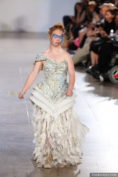 Модели, которые вдохновляют не только красотой, но и невероятной силой духа