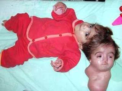 "Шоссе смерти" в Ираке: 15 лет жертвы радиации рожают уродов. ШОКИРУЮЩИЕ КАДРЫ