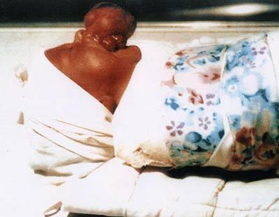 "Шоссе смерти" в Ираке: 15 лет жертвы радиации рожают уродов. ШОКИРУЮЩИЕ КАДРЫ