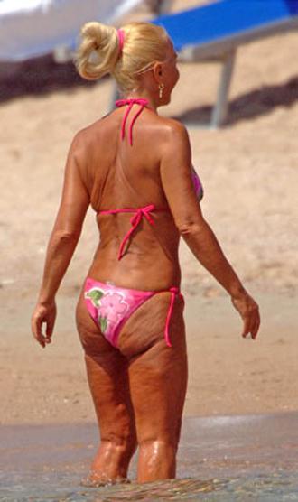 Самые ужасные ФОТО звезд