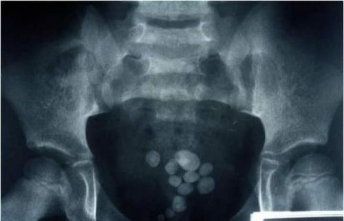 Люди, которые сделали операции сами себе