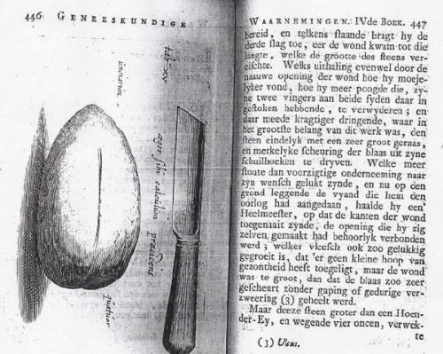 Люди, которые сделали операции сами себе