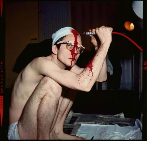 Люди, которые сделали операции сами себе