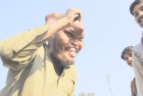 Пакистанский нищий шокировал окружающих своим видом