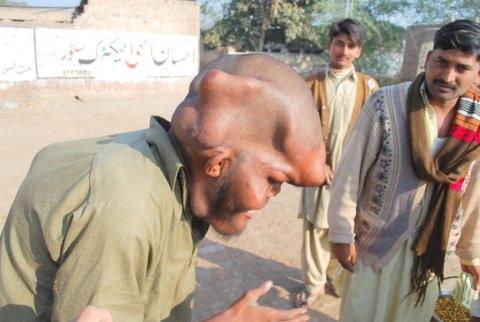 Пакистанский нищий шокировал окружающих своим видом