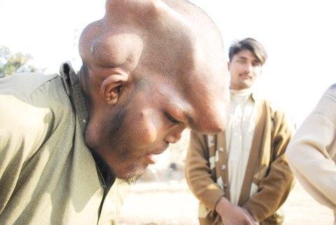 Пакистанский нищий шокировал окружающих своим видом