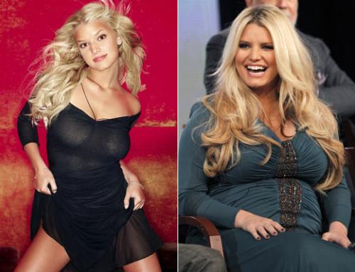 От Джоли до Пугачевой: внезапно похудевшие знаменитости