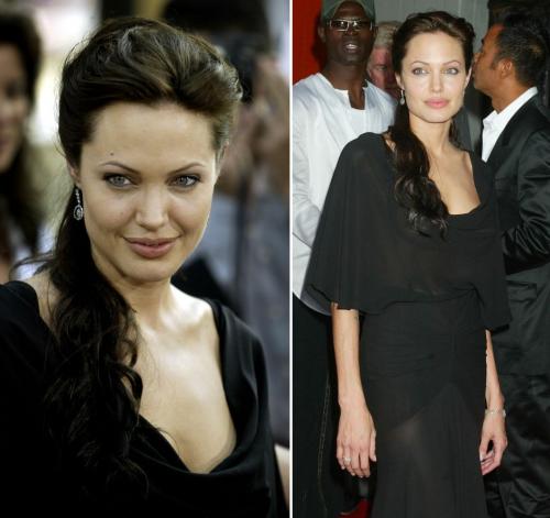 От Джоли до Пугачевой: внезапно похудевшие знаменитости