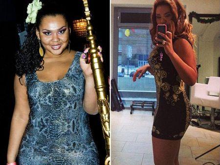 От Джоли до Пугачевой: внезапно похудевшие знаменитости