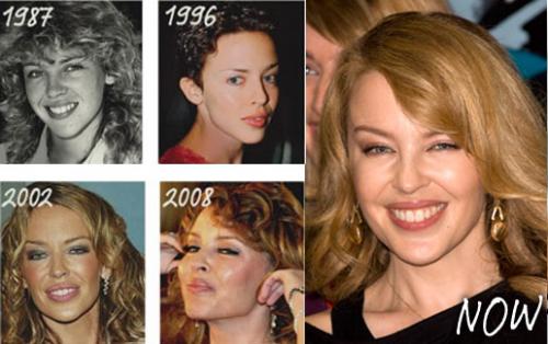 «Невесту Вильденштайна»  встретили в аэропорту