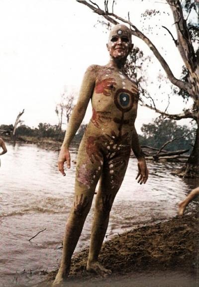 Первый в мире бесполый человек родом из Австралии