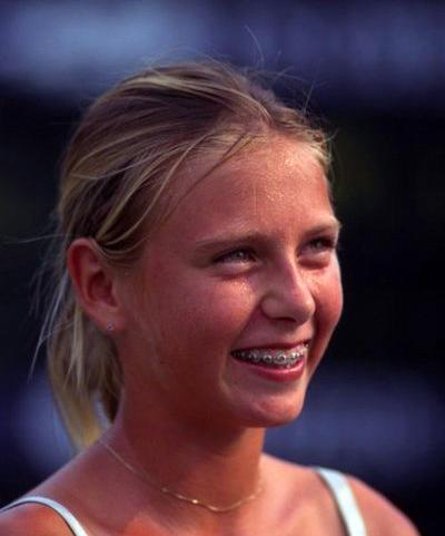 Звездные брекеты