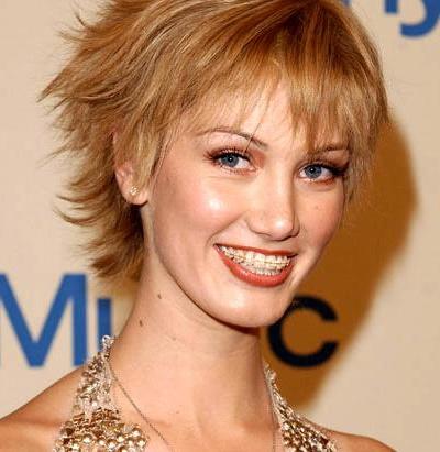 Звездные брекеты