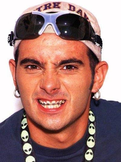 Звездные брекеты