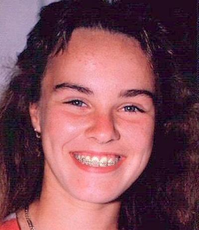 Звездные брекеты