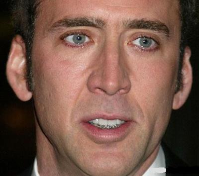 Звездные брекеты