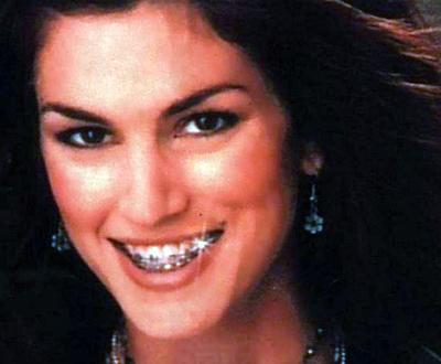 Звездные брекеты