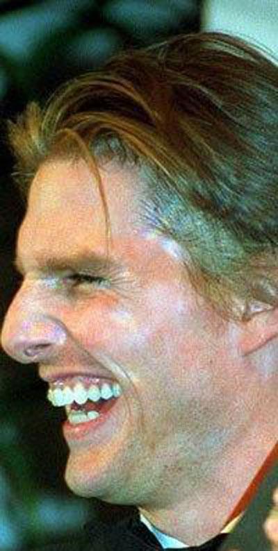 Не в фокусе и не в ракурсе: неудачные фото знаменитостей