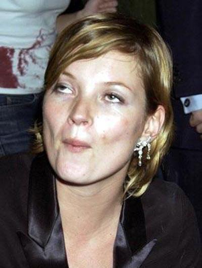 Не в фокусе и не в ракурсе: неудачные фото знаменитостей