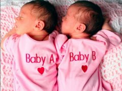 10 невероятных правдивых историй о близнецах