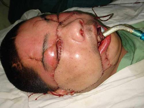 Страх за деньги: жертвы аттракционов с животными