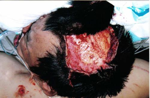 Страх за деньги: жертвы аттракционов с животными