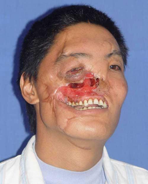 Страх за деньги: жертвы аттракционов с животными