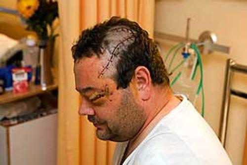 Страх за деньги: жертвы аттракционов с животными