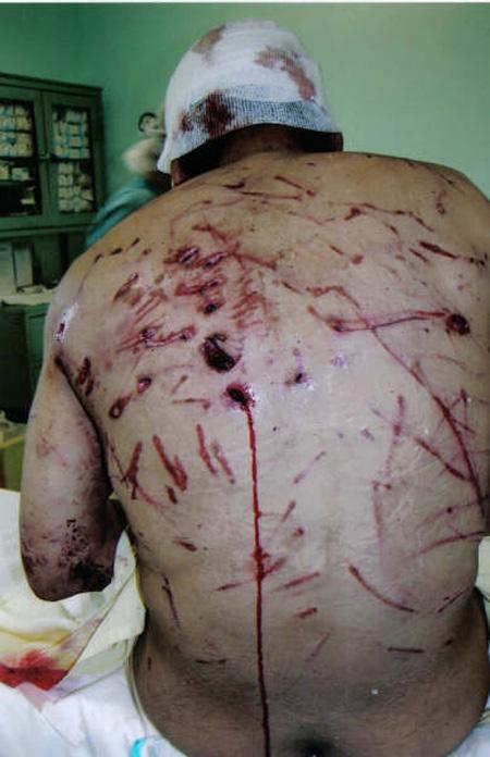 Страх за деньги: жертвы аттракционов с животными