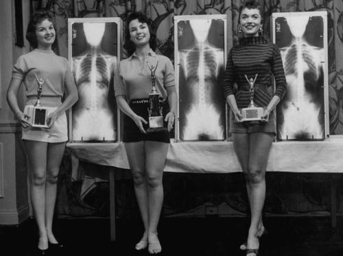 Как выглядели победительницы конкурсов красоты в 20 веке
