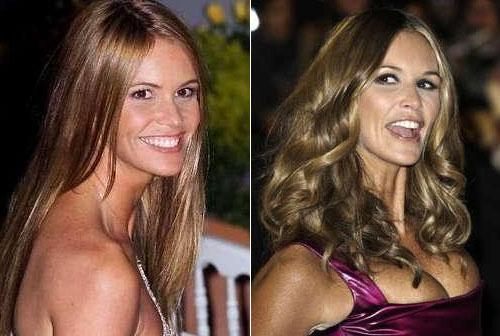 Рецепт молодости: звёзды без возраста