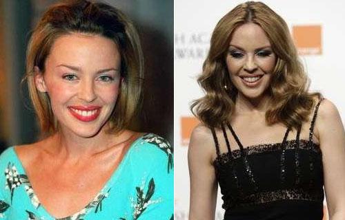 Рецепт молодости: звёзды без возраста