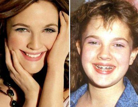 Гадкие утята, превратившееся в красавиц и красавцев