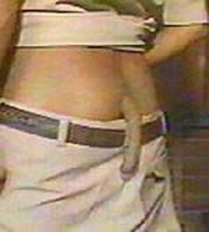 Удивительные тела: невероятные генетические ошибки