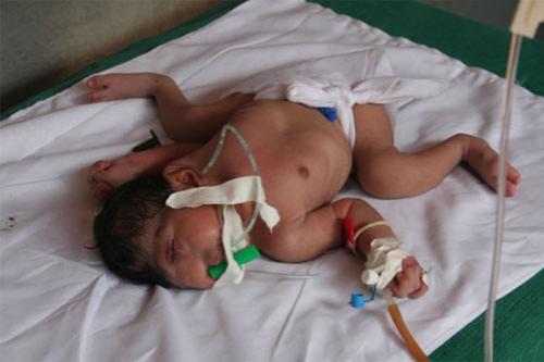 Удивительные тела: невероятные генетические ошибки