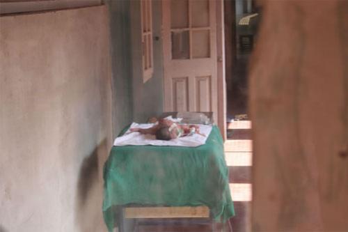 Удивительные тела: невероятные генетические ошибки