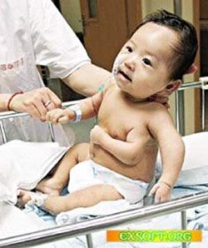 Удивительные тела: невероятные генетические ошибки