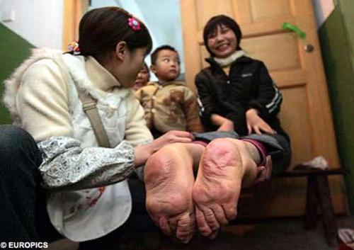 Удивительные тела: невероятные генетические ошибки