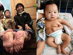 Удивительные тела: невероятные генетические ошибки