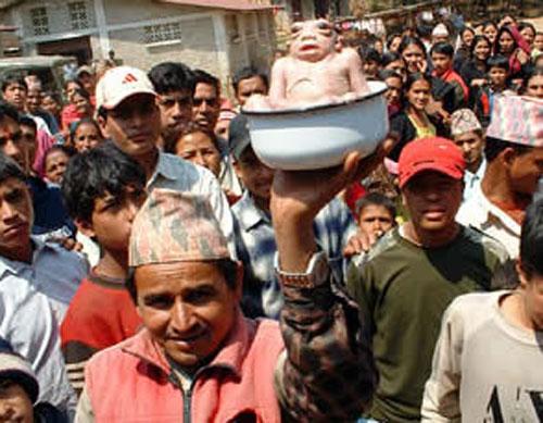 Удивительные тела: невероятные генетические ошибки