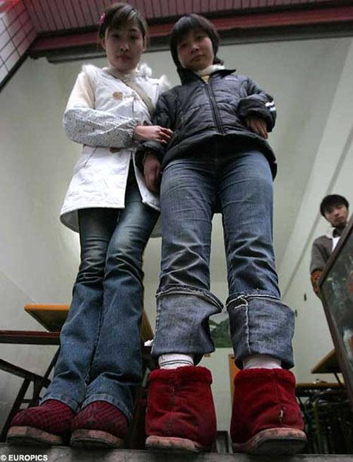 Удивительные тела: невероятные генетические ошибки