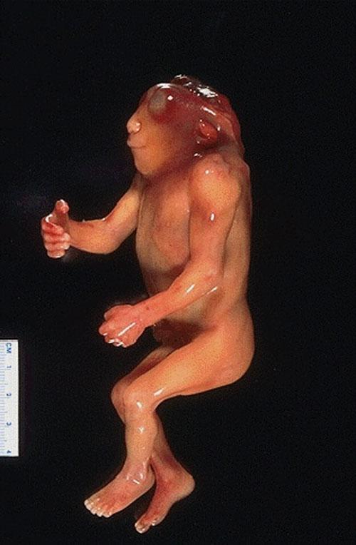 Удивительные тела: невероятные генетические ошибки