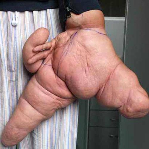 Удивительные тела: невероятные генетические ошибки