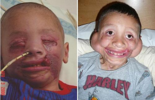 12 людей, переживших настоящий кошмар и сумевших выжить