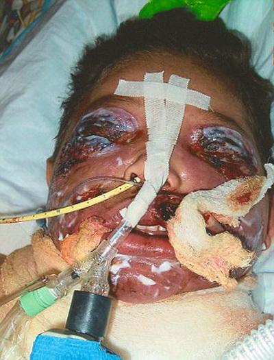 12 людей, переживших настоящий кошмар и сумевших выжить