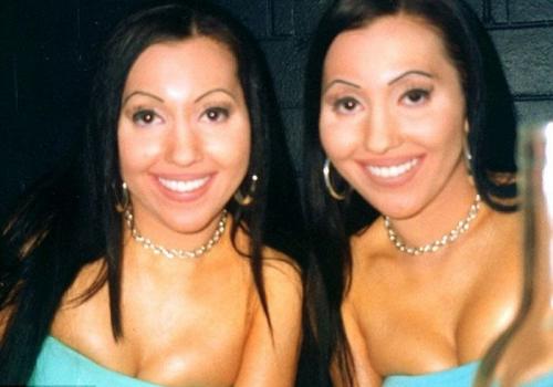 Сестры-близнецы потратили  000, чтоб быть еще более похожими друг на друга