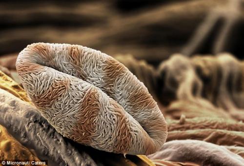 Возбудители сенной лихорадки попали под микроскоп